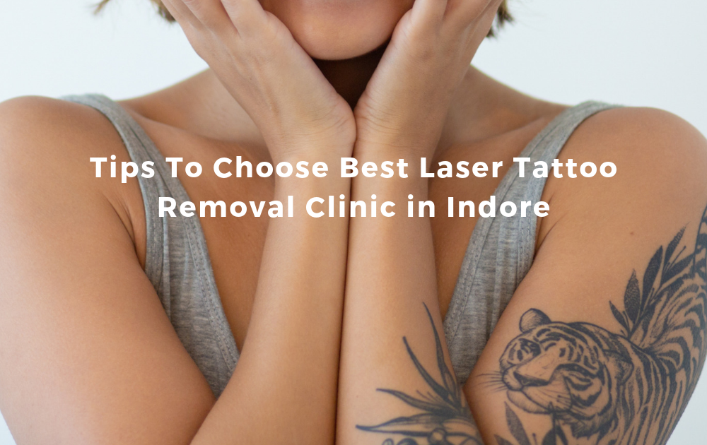 Tips To Choose Best Laser Tattoo Removal Clinic in Indore