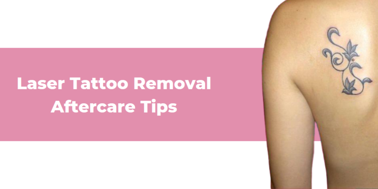 Laser Tattoo Removal Aftercare Tips - Dr. Nishant Khare Laser Tattoo Removal Aftercare Tips - Dr. Nishant Khare