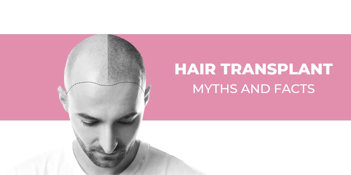 Hair Transplant Myths and Facts - Hair Transplant in Indore - Dr. Nishant Hair Transplant Myths and Facts - Hair Transplant in Indore - Dr. Nishant