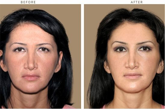 img-surgery